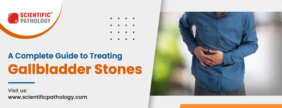 A Complete Guide to Treating Gallbladder Stones
